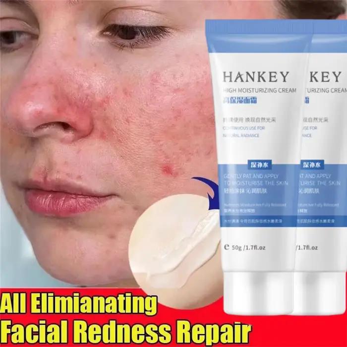 Crème Réductrice de Rougeurs Faciales, Améliore la Peau Sensible et la Sécheresse, Hydratant Apaisan