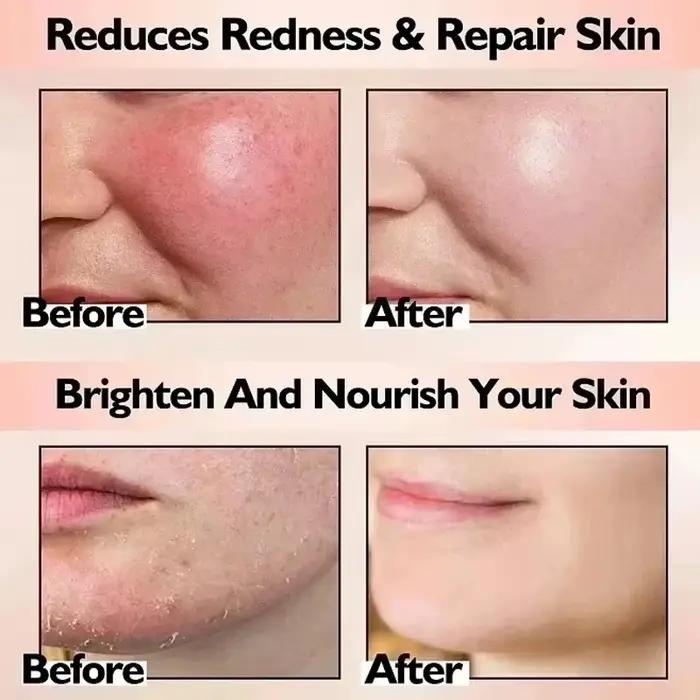 Crème Réductrice de Rougeurs Faciales