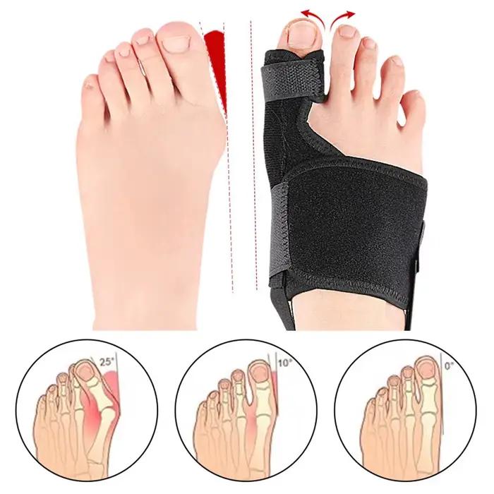 Correcteur d'orteils orthèses, ajusteur de pouce, marteau protecteur, correcteur d'hallux Valgus, correcteur d'oignon, outil orthopédique, outils de soins
