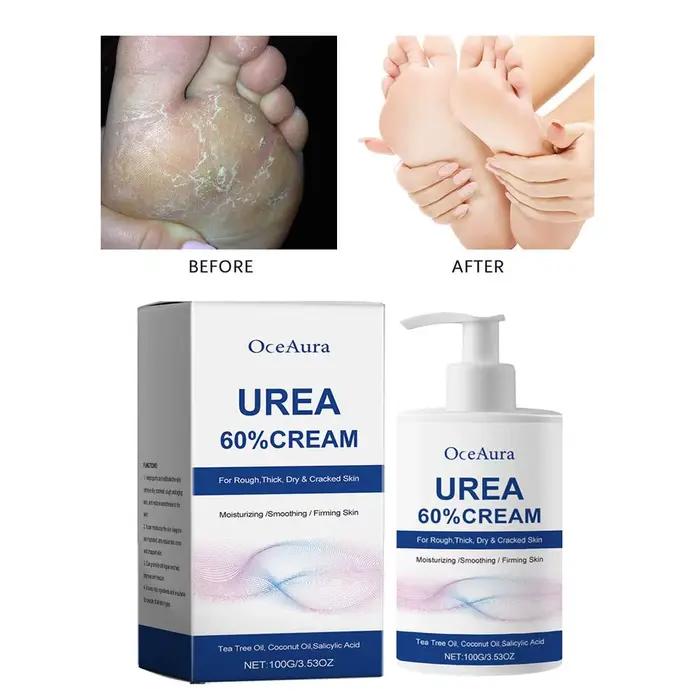 Crème pour les pieds à l'urée