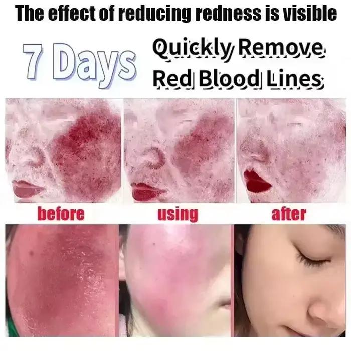 Crème Réductrice de Rougeurs Faciales