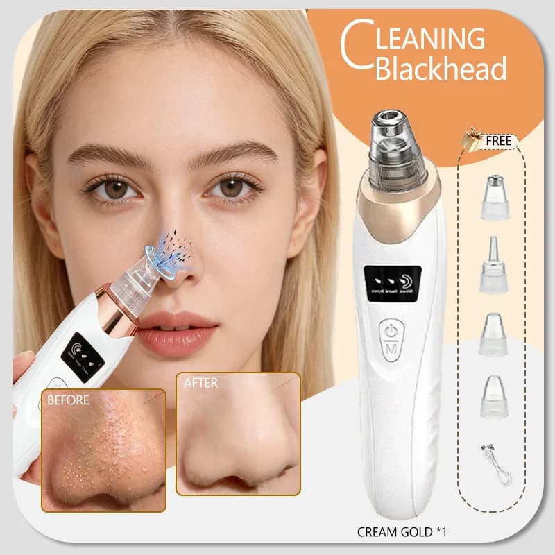 Extracteur de points noirs, appareil de nettoyage de la peau du visage pour éliminer les points noir