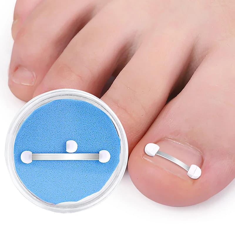 Correcteur d'ongles incarnés, outils de pédicure, récupération intégrée, traitement des ongles des o