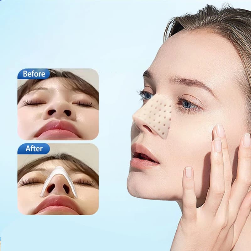 Attelle nasale thermoplastique basse température attelle de rhinoplastie orthès immobilisée attelle 