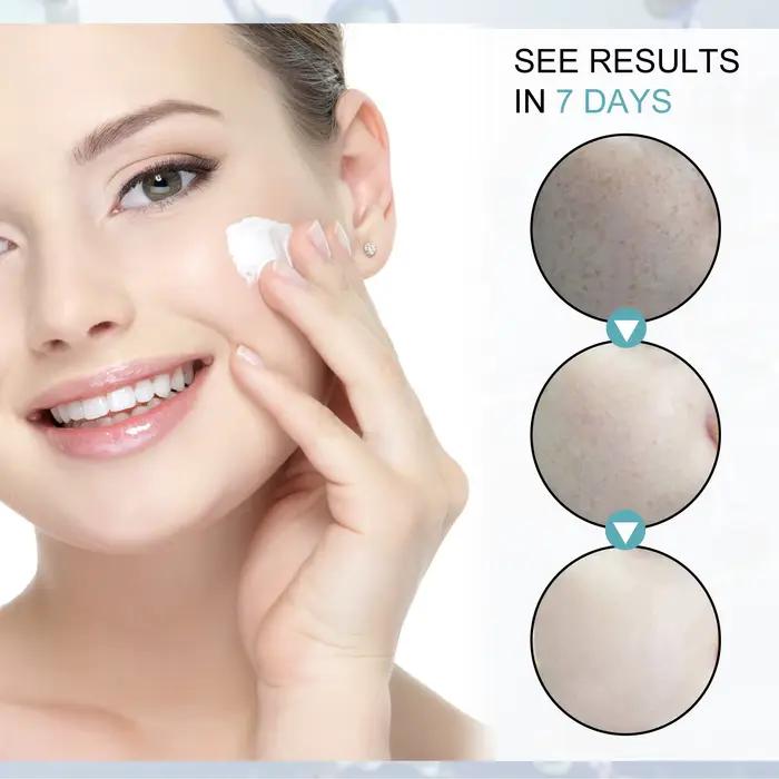 Crème Blancheur Taches de Rousserie Niacinamide Hydratante pour Femmes Élégante à Offrir Occasions Spéciales