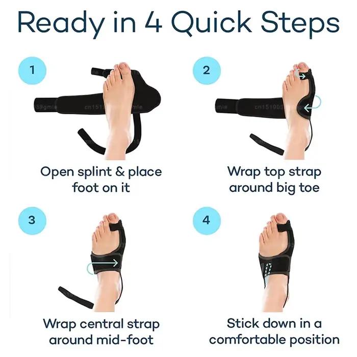 Correcteur de pied, attelle d'oignon, Correction d'hallux Valgus, redresseur de gros orteils, correcteur orthopédique, pédicure, protection des orteils