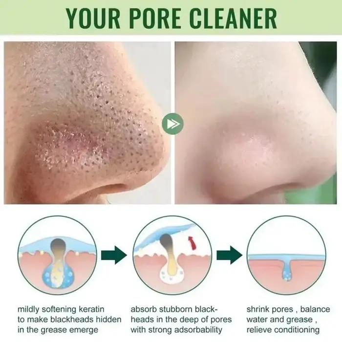 Masque Facial Original pour éliminer les points noirs, thé vert, solide, traitement des imperfections d'acné, points noirs, bâton propre, crème rétrécit les Pores, soins de la peau