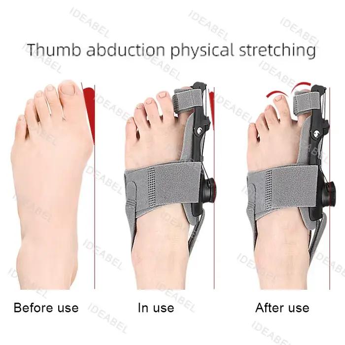 Attelle orthopédique correctrice pour hallux valgus, redresseur d'orteil, soulagement de la douleur au pied, correction du hallux valgus, soins des pieds