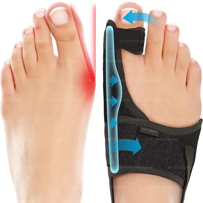 Correcteur de pied, attelle d'oignon, Correction d'hallux Valgus, redresseur de gros orteils, correcteur orthopédique, pédicure, protection des orteils