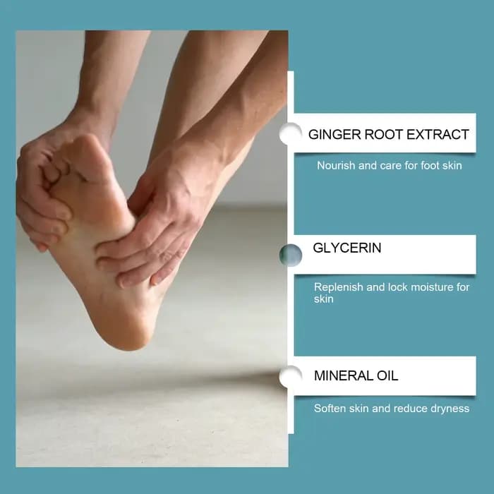 Crème pour les pieds : Soin délicat des talons