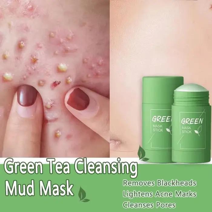 Masque Facial Original pour éliminer les points noirs, thé vert, solide, traitement des imperfections d'acné, points noirs, bâton propre, crème rétrécit les Pores, soins de la peau