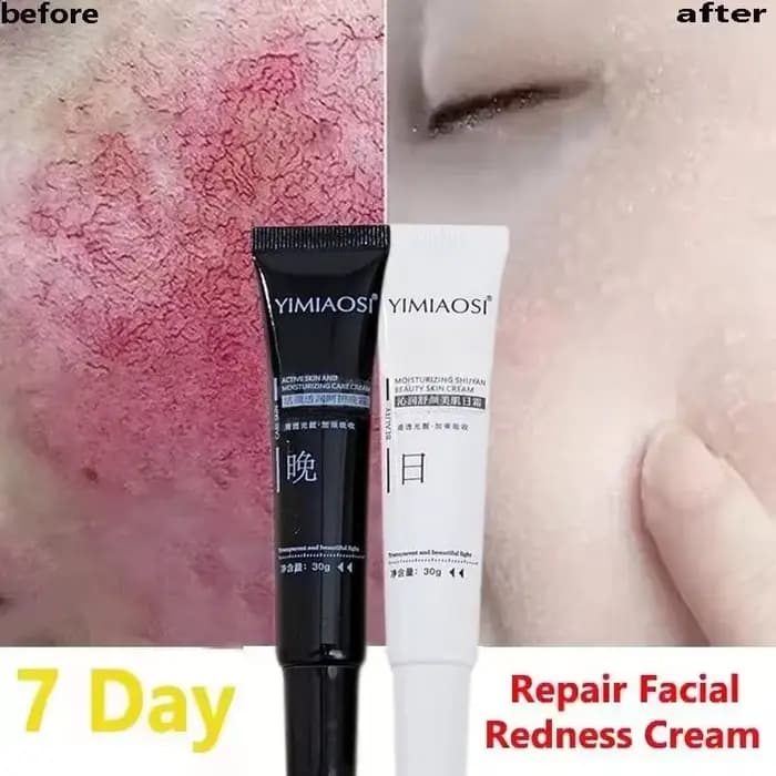 Crème réparatrice des rougeurs du visage coréenne