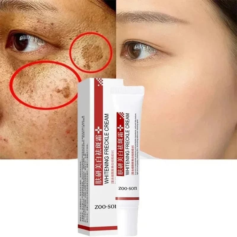 Crème blanchissante pour les taches de rousseur, élimine les taches foncées, crème pour le visage, N